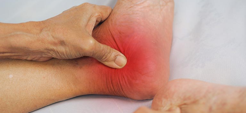 How does Reflexology Soothe Arthritis Symptoms?